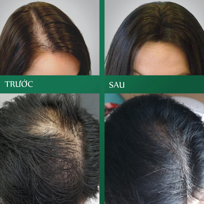 Trà Ngũ Hắc Thảo Mộc Thiên Nhiên - Hỗ trợ mọc tóc nhanh, giảm rụng tóc, đen tóc tự nhiên, Hộp 30 Gói